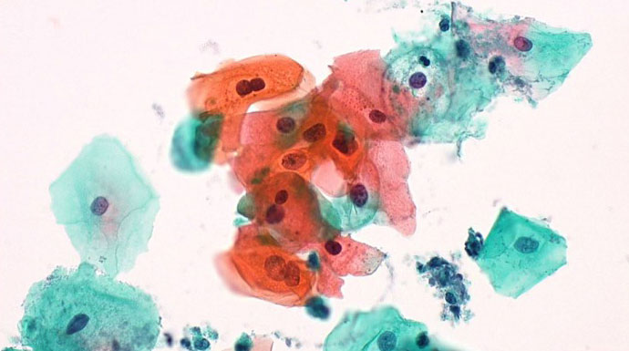 細胞診標本